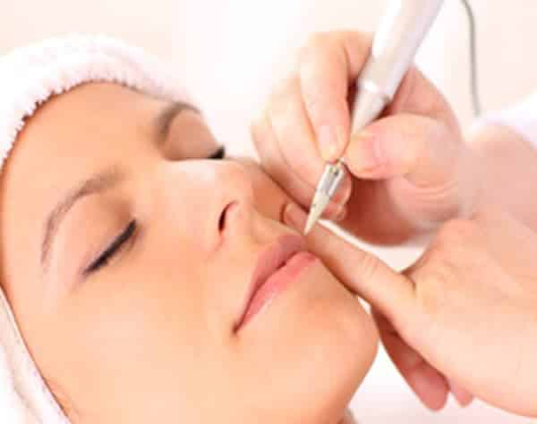 The best way for permanent dark and grey hair removal is: Electrolysis