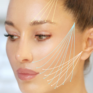 THREAD LIFT 